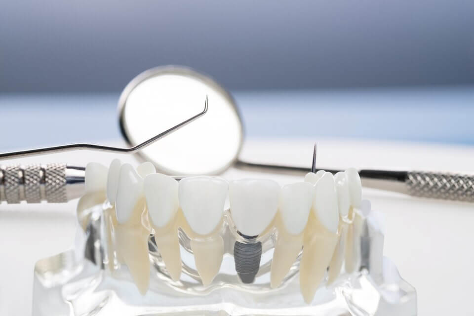 Preventative Dentistry